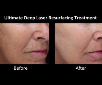 photos of cosmetic before and after