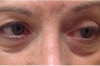 permanent makeup