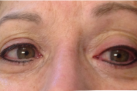 Permanent Makeup - eyeliner - After