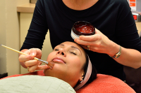 cosmetics-chemical peel
