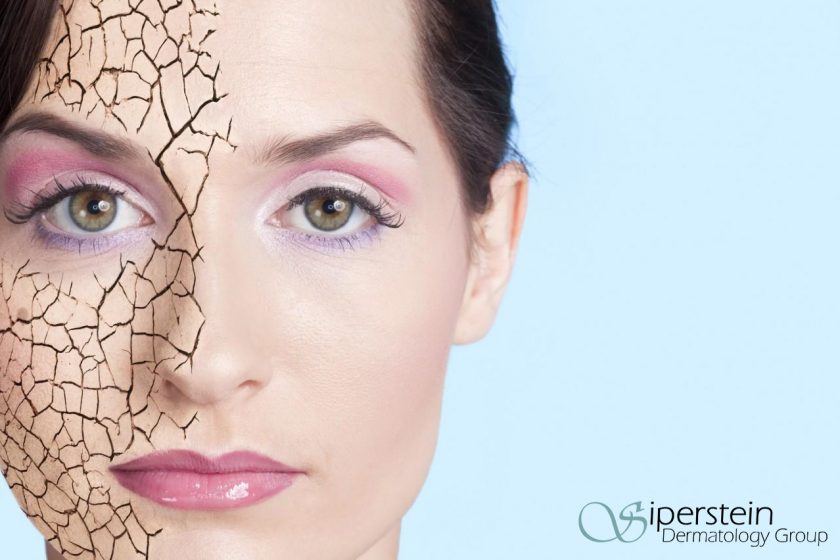 Healthy Skin