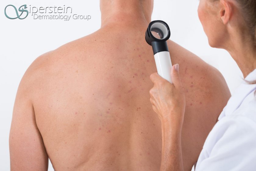 skin problems
