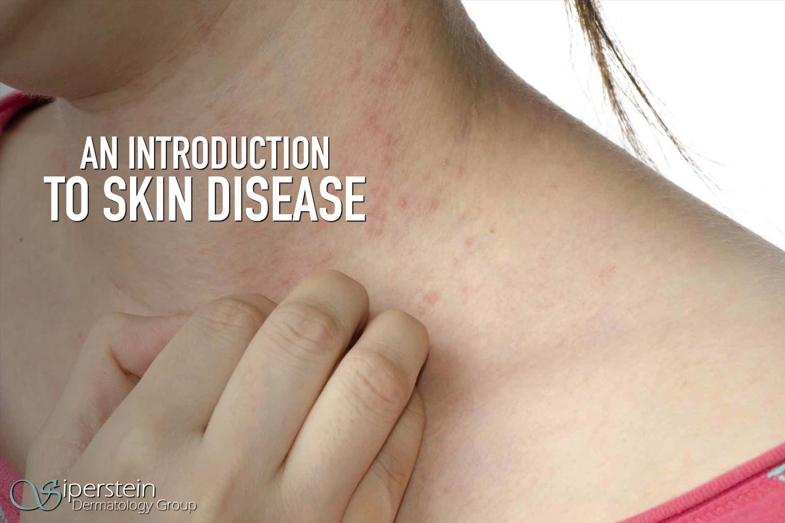 thesis on skin diseases