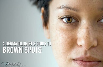 Brown Spots