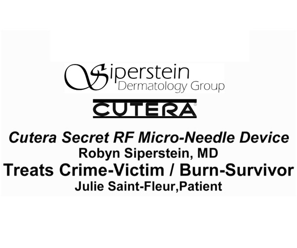Cutera Secret RF Microneedling helps burn victim