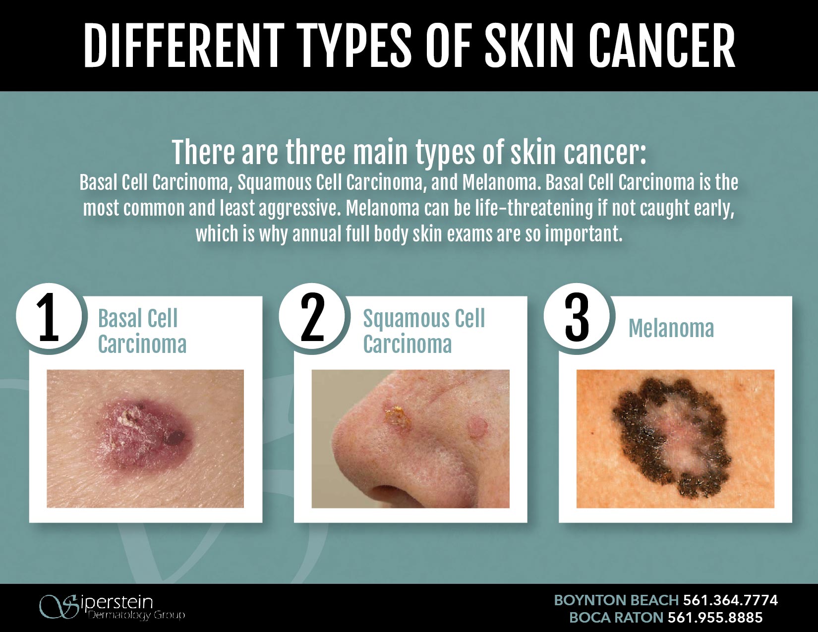 new research on skin cancer