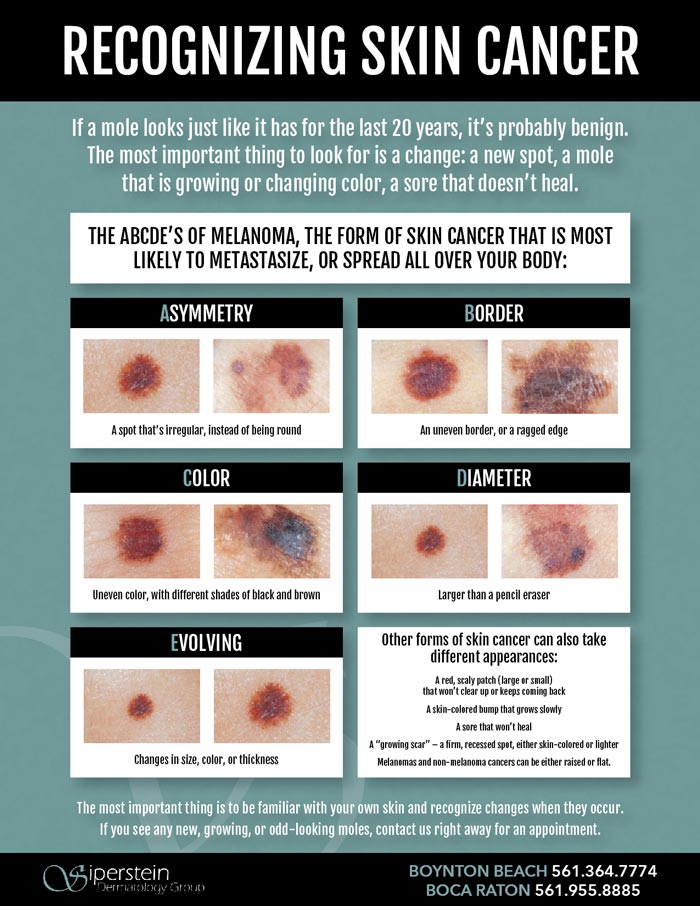 Recognizing Skin Cancer