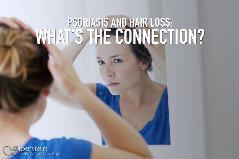 Psoriasis And Hair Loss