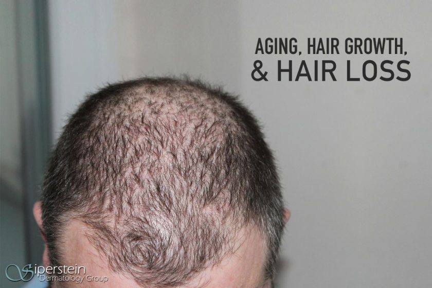 Experts Discuss All The Questions Related To Aging & Hair