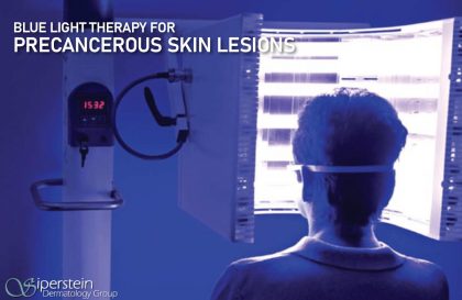 blue light therapy