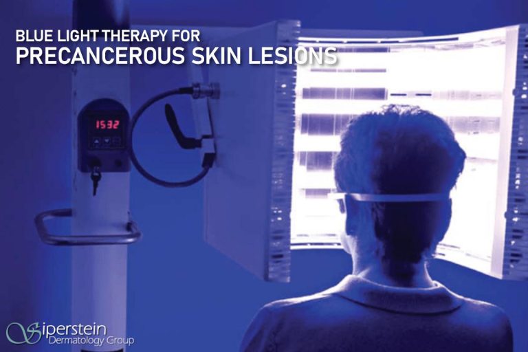 FAQs About Blue Light Therapy For Precancerous Skin Lesions