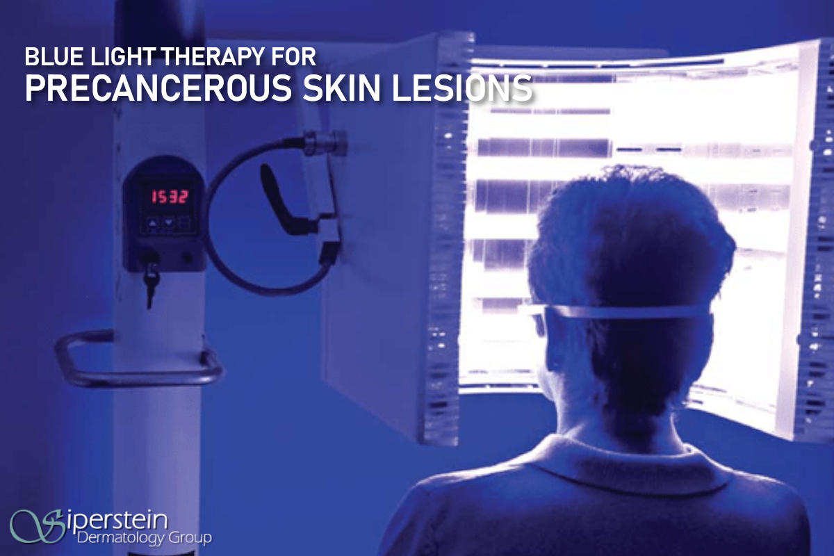 FAQs About Blue Light Therapy For Precancerous Skin Lesions
