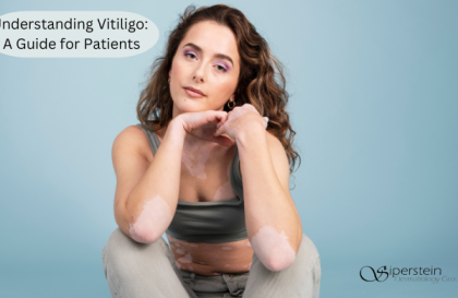 Understanding Vitiligo A Guide for Patients