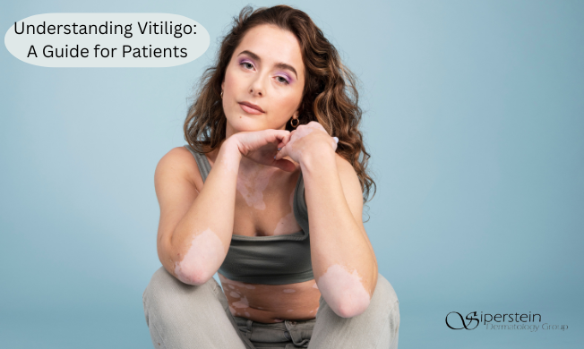 Understanding Vitiligo A Guide for Patients